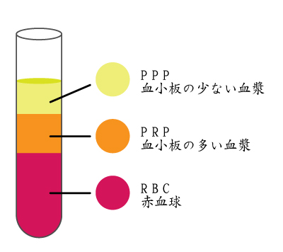膝の再生医療PRP療法と鍼灸